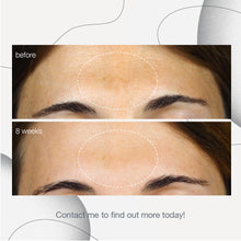 Load image into Gallery viewer, PowerBright Dark Spot Serum