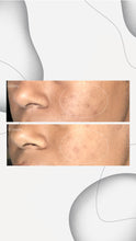 Load image into Gallery viewer, PowerBright Dark Spot Serum